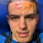 “Heroj” Krstović pokazao rane: Atalanti je trebao centarfor stare škole