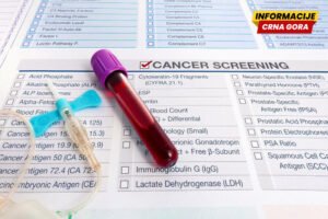 IJZ: Odziv građana na skrining program za rano otkrivanje raka debelog crijeva i dalje ispod željenog nivoa