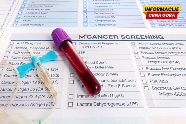 IJZ: Odziv građana na skrining program za rano otkrivanje raka debelog crijeva i dalje ispod željenog nivoa