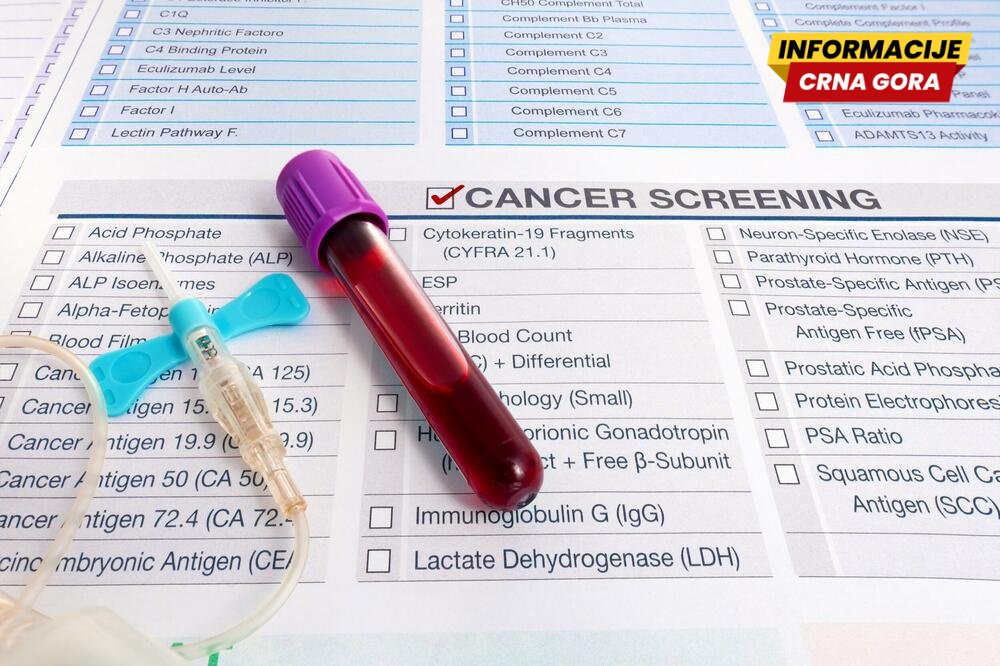 IJZ: Odziv građana na skrining program za rano otkrivanje raka debelog crijeva i dalje ispod željenog nivoa