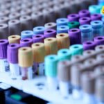 Jedna krvna grupa izgleda da nosi veći rizik od dijabetesa tipa 2