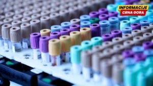 Jedna krvna grupa izgleda da nosi veći rizik od dijabetesa tipa 2