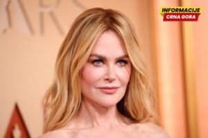 Drama na setu: Nikol Kidman hitno hospitalizovana