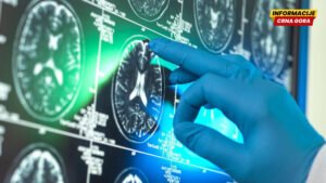 ‘Inovativni’ lekovi protiv Alchajmera ne pomažu značajno: analiza