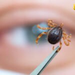 Sve što treba da znate o ujedu krpelja