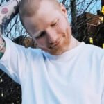 Ed Širan otkrio da je morao da se ošiša zbog bolesti