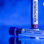 Italija: Testovi na hantavirus negativni, šest ljudi pod medicinskiim nadzorima