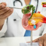 Belgijski naučnici otkrili da ćelije raka koriste hranljive materije prisutne u jetri kako bi zaobišle imuni sistem